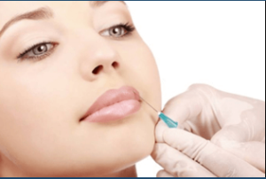Dermal Fillers